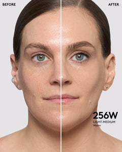256W